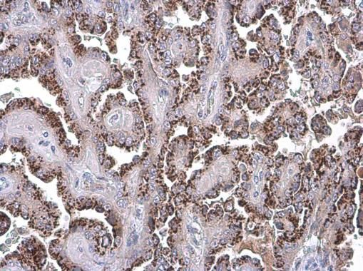 GOLPH2 Rabbit Polyclonal Antibody