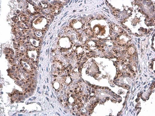 GOLPH2 Rabbit Polyclonal Antibody