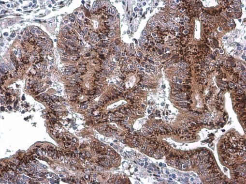 GOLPH2 Rabbit Polyclonal Antibody