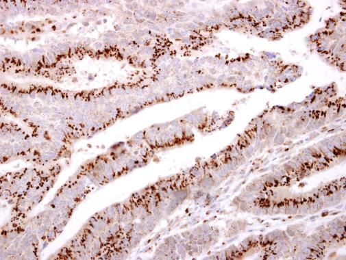 GOLPH2 Rabbit Polyclonal Antibody