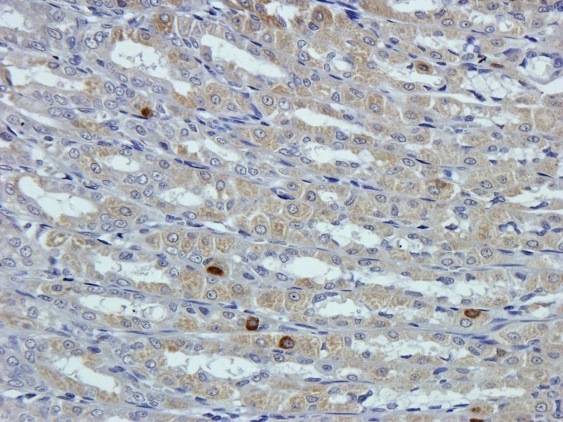 GPC3 Rabbit Polyclonal Antibody