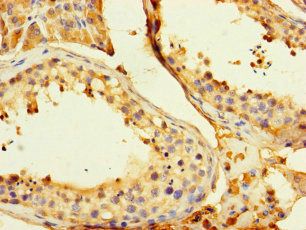 GPD2 Antibody