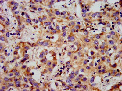 GPR1 Antibody