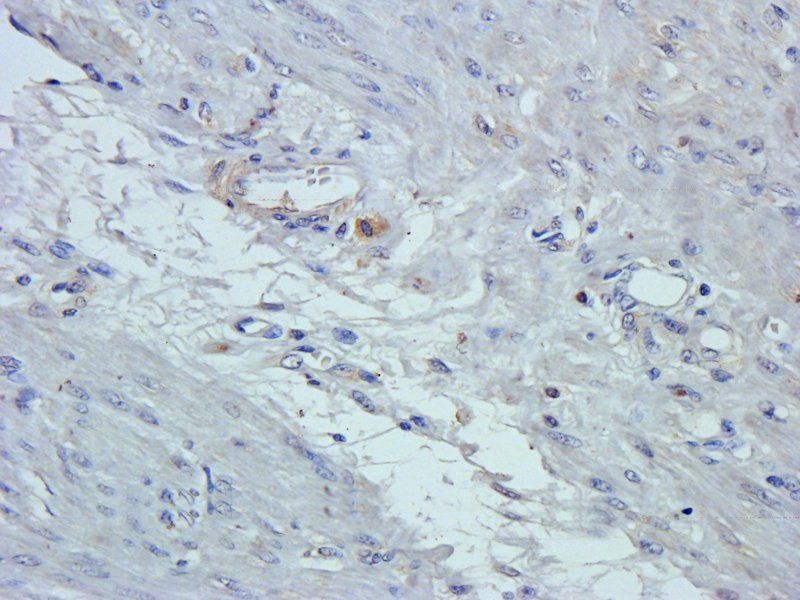 GPR109A Rabbit Polyclonal Antibody