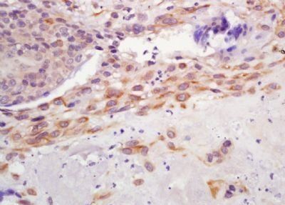 GPR126 Rabbit Polyclonal Antibody