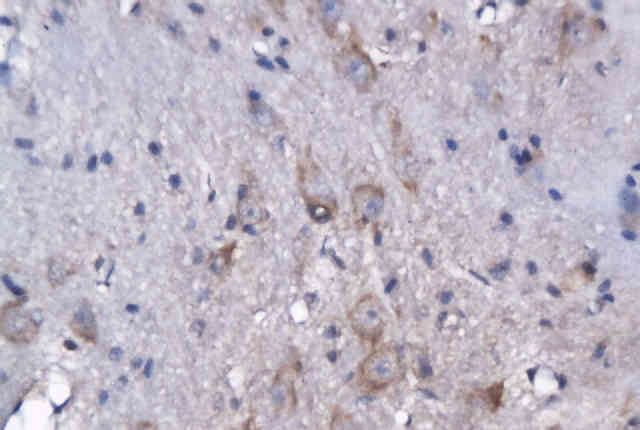 GPR55 Rabbit Polyclonal Antibody