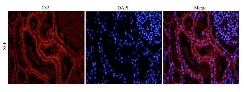 GPR55 Rabbit Polyclonal Antibody