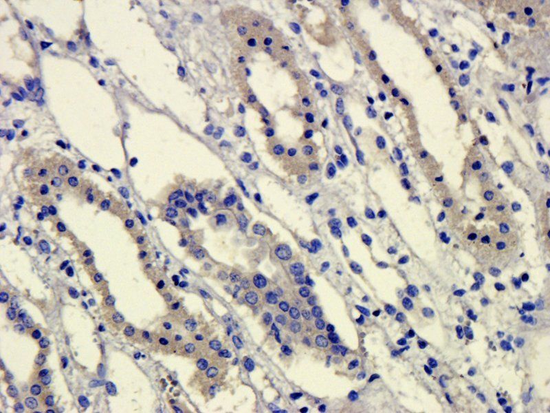 GPR55 Rabbit Polyclonal Antibody