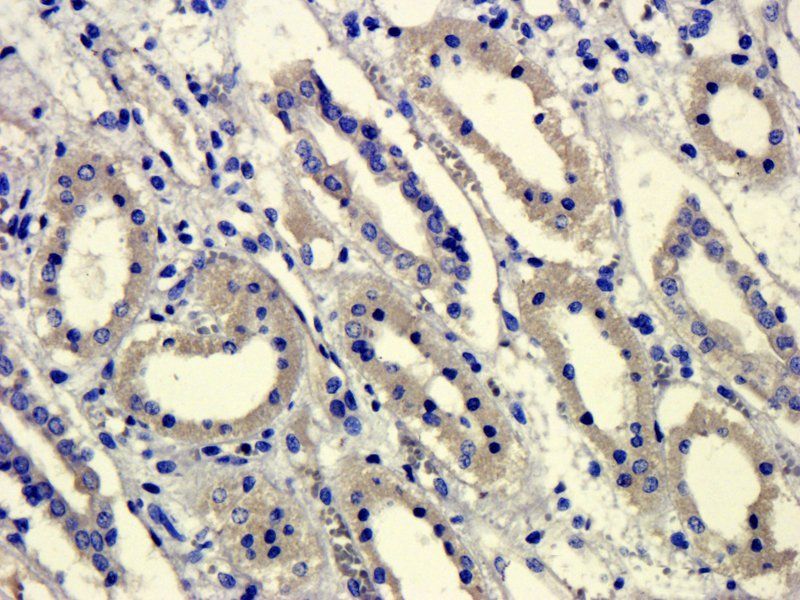 GPR55 Rabbit Polyclonal Antibody