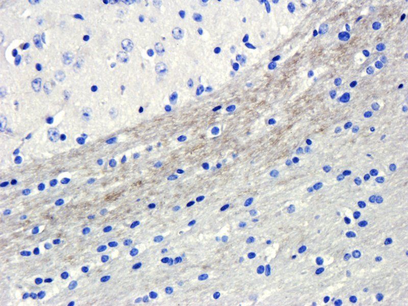 GPR55 Rabbit Polyclonal Antibody