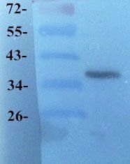 GPR55 Rabbit Polyclonal Antibody