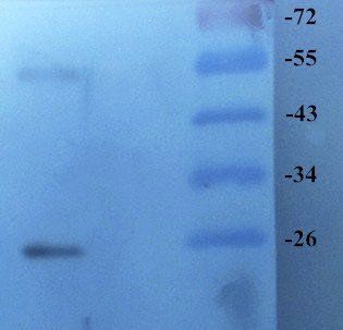 GPR55 Rabbit Polyclonal Antibody