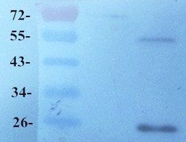 GPR55 Rabbit Polyclonal Antibody
