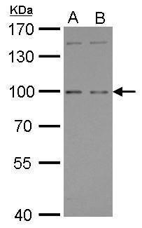PTGFRN Rabbit Polyclonal Antibody