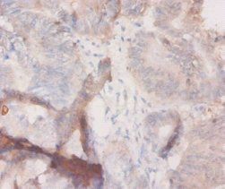 CSF3 Antibody