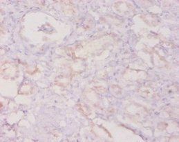 CSF3 Antibody