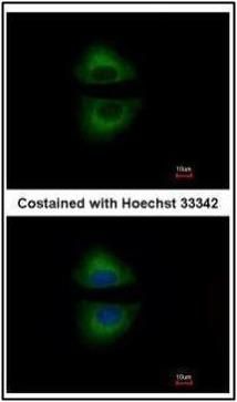 GRAP Rabbit Polyclonal Antibody