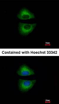 GRAP Rabbit Polyclonal Antibody