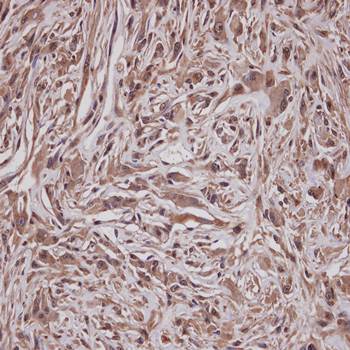GRAP Rabbit Polyclonal Antibody