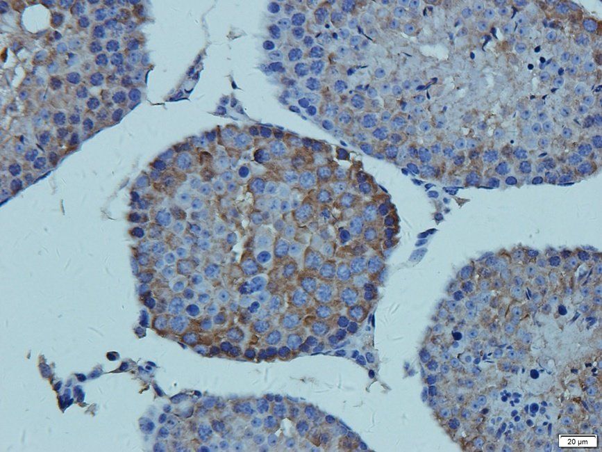 CD41 Rabbit Polyclonal Antibody