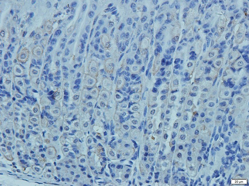 CD41 Rabbit Polyclonal Antibody