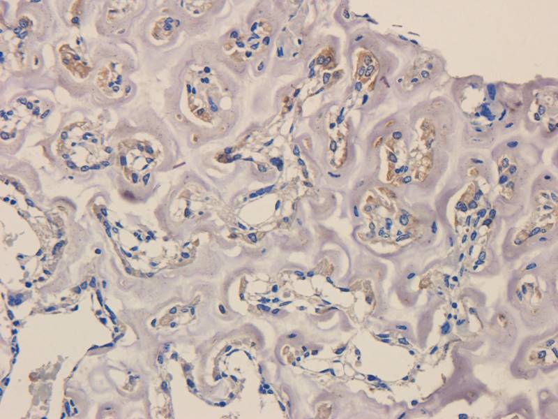 Gremlin 1 Rabbit Polyclonal Antibody