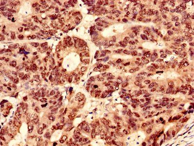 GRHL2 Antibody