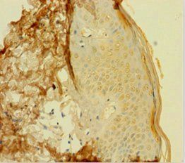 GRHL2 Antibody