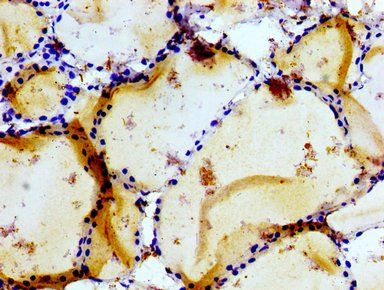 GRIK1 Antibody