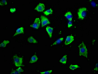 GRIK2 Antibody