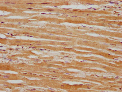 GRIK2 Antibody