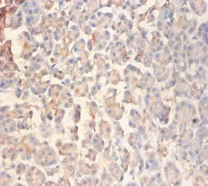 GRIN2A Antibody