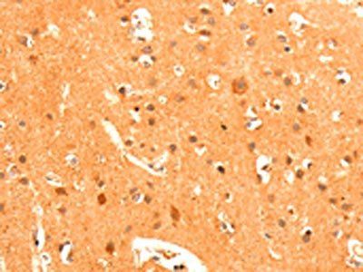 GRM3 Antibody