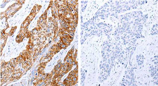 GRPR Rabbit Polyclonal Antibody