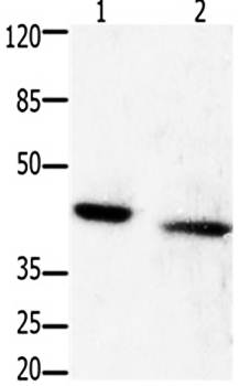 GRPR Rabbit Polyclonal Antibody