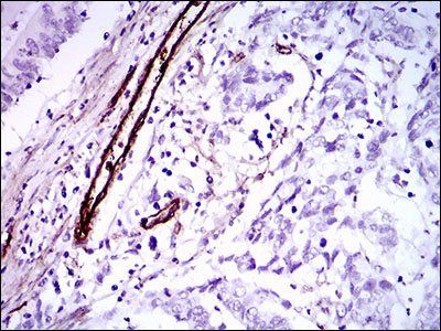 GSC Antibody