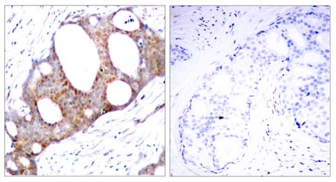 GSK3α (Phospho-Ser21) Antibody