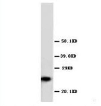 GST3/GST pi/GSTP1 Rabbit Polyclonal Antibody