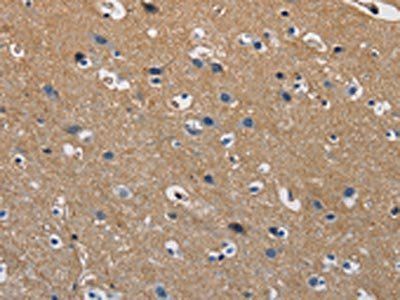 GSTA2 Antibody