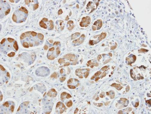 GSAT1/GSAT2/GSAT3 Rabbit Polyclonal Antibody