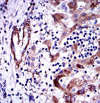 GSTM1 Antibody