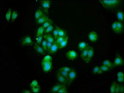 GUCA2B Antibody