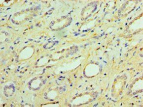 GUCA2B Antibody