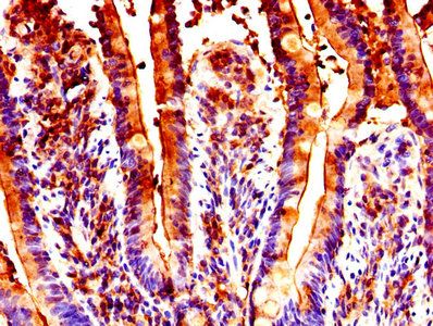 GUCA2B Antibody