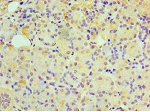GUCA2B Antibody