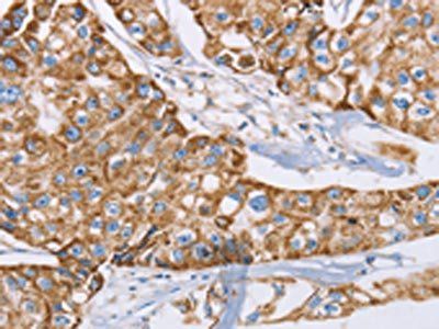 GUCY1A1 Antibody