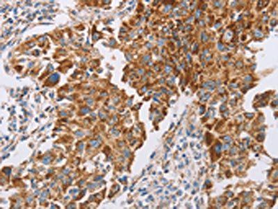 GUCY1A1 Antibody