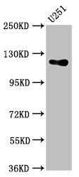 GUCY2D Antibody