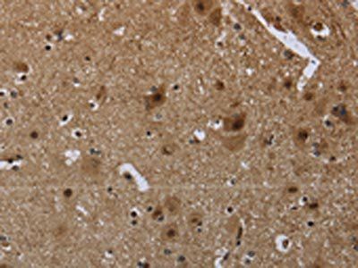 GYPC Antibody