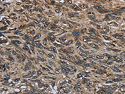 GYPC Antibody